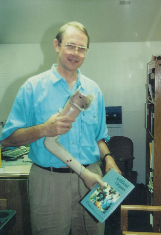 Artificial Arm